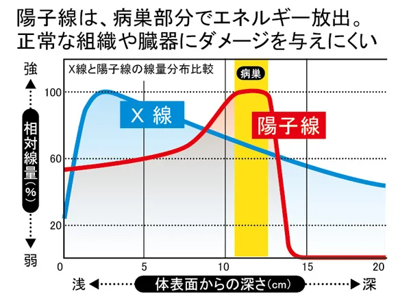 陽子線は、病巣部分でエネルギー放出。
