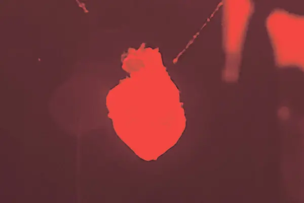 培養液の中で「iPS心臓」がドクドクと拍動する